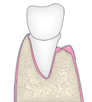 正常な顎骨
