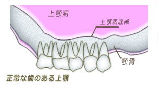 正常な歯のある上顎